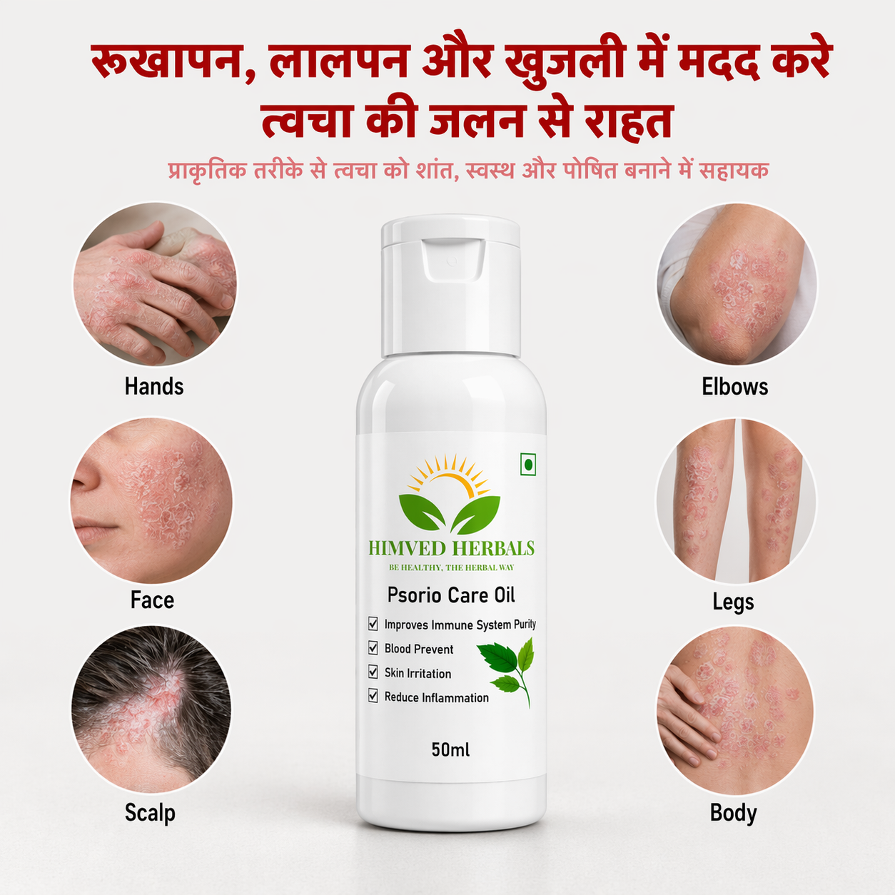 Psorio Care Oil