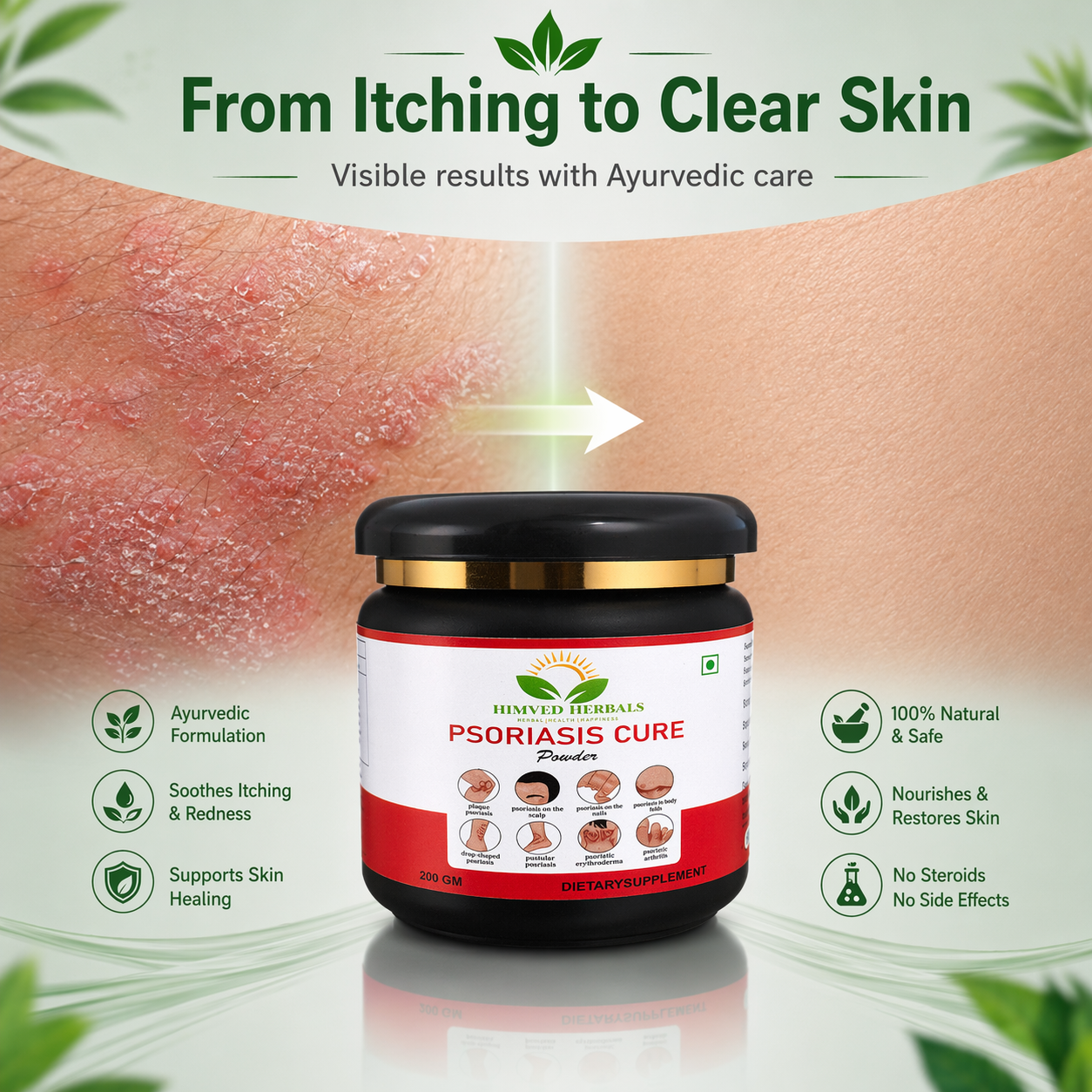 Psoriasis Cure Powder
